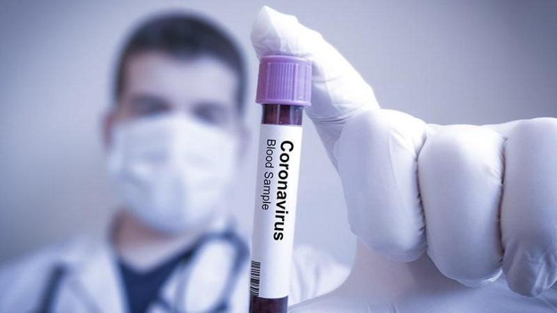 Belarus+koronavir%C3%BCs%C3%BC+umursam%C4%B1yor%21;