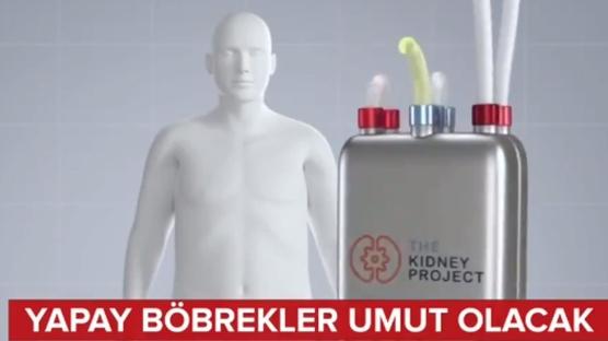 Yapay böbrekler umut olacak 