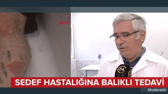 Sedef hastalığına balıklı tedavi 