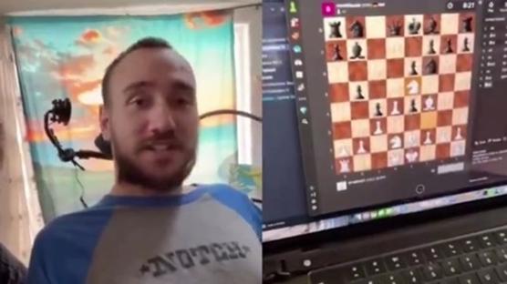 Elon Musk paylaştı! Beyin çipi takılan felçli hasta düşünce gücüyle satranç oynadı 