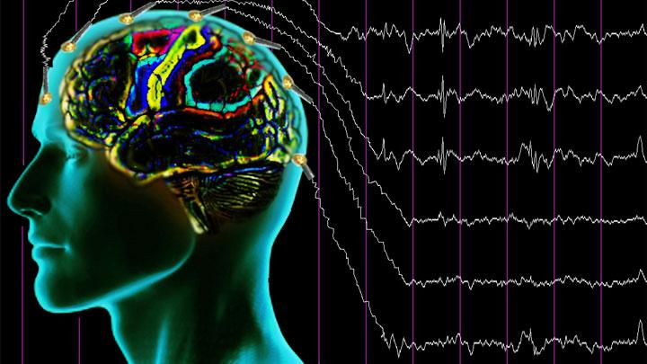 Spor, erkeklerde epilepsi riskini azaltabilir