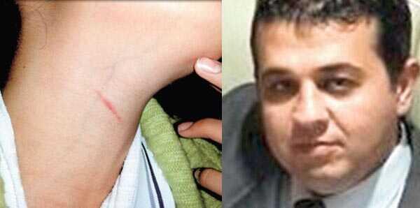 rencisine, 'Bilek kesmem boaz keserim' dedi kesti