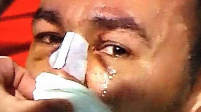 Umut Bulut gzyalarn tutamad