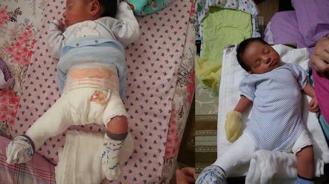 Doumda baca krlan bebek iin 43 bin lira tazminat