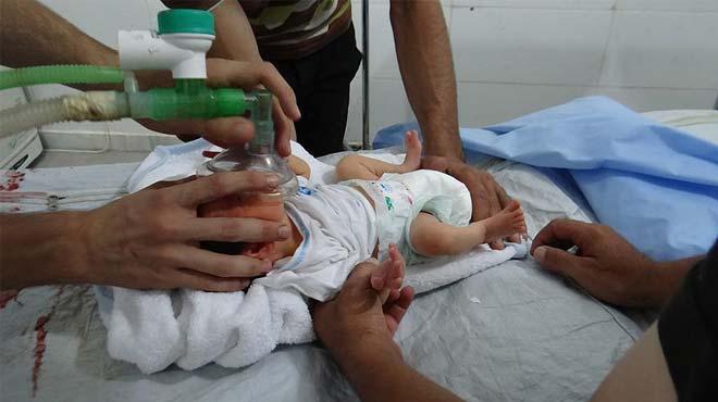 Esed gleri bebekleri klor gazyla vurdu