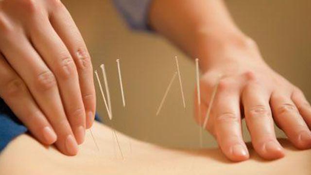 Akupunktur antidepresan kullanmn azaltabilir