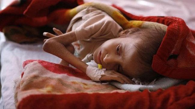 Yemen'de insani kriz: Sava, kuraklk, yoksulluk