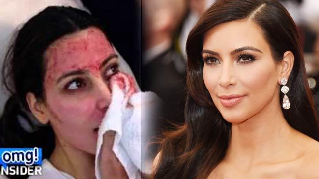 Kim Kardashian'n 'genlik forml' Trkiye'ye geldi