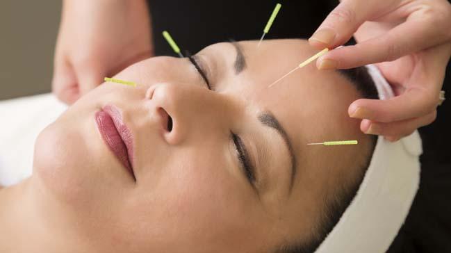 Amerika Gda ve la Dairesi doktorlara akupunktur tavsiye etti