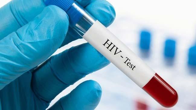 HIV listesine her yl 2 bin kii ekleniyor