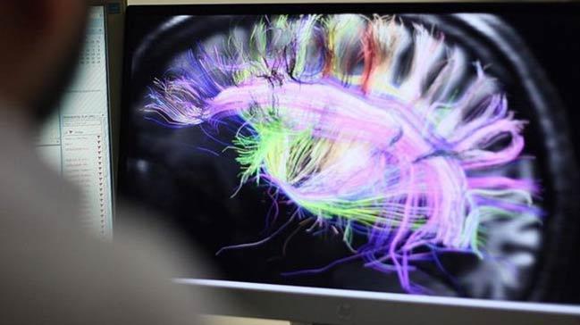 Beynin elektrik balantlarnn haritas karld