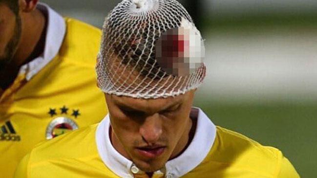 Soyunma odasnda mdahale! Skrtel kanlar iinde kald