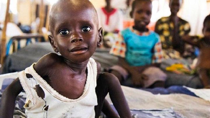 Uluslararas sivil toplum rgt Save the Children: Gney Sudan'da 20 bin ocuk alktan lebilir