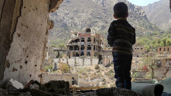 BM Dnya Gda Program Direktr: Yemen'de hastanelere getirilen 50 ocuktan 30'u lme gnderiliyor