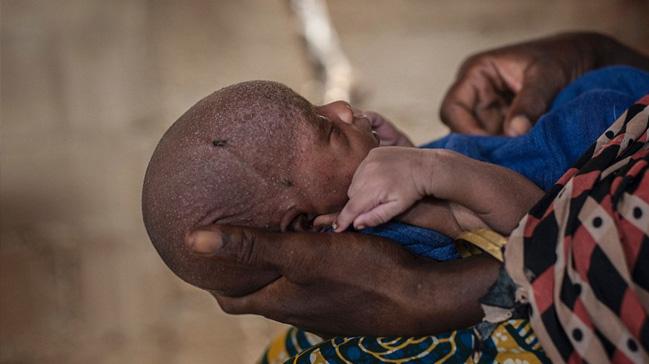 Nijerya'da alktan 3 ayda 30 ocuk ld
