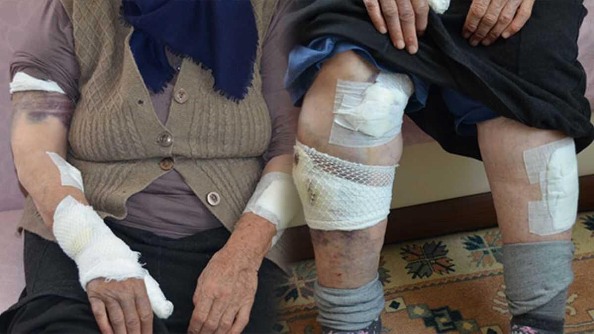 Köpeklerin saldırdığı yaşlı kadını ölümden komşuları kurtardı