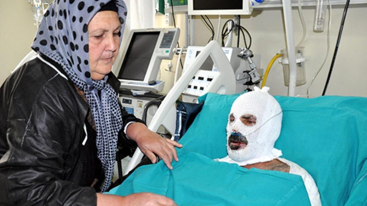 Nahcivan'da yand, Erzurum'da tedavi gryor