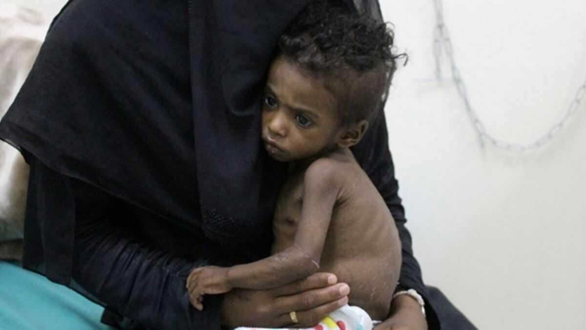 UNICEF bu yl 350 bin Yemenli'ye insani yardmda bulundu