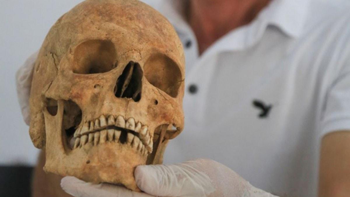Euromos Antik Kenti'nde 2 bin 200 yllk beyin ameliyat geirmi kafatas bulundu
