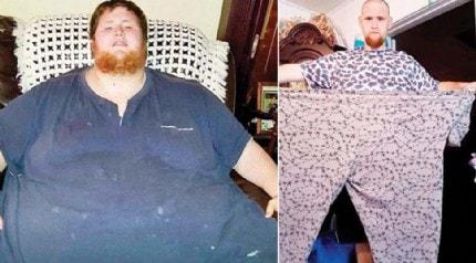 O diyet hayatn kurtard! 363 kilodan bakn ka kiloya dt?