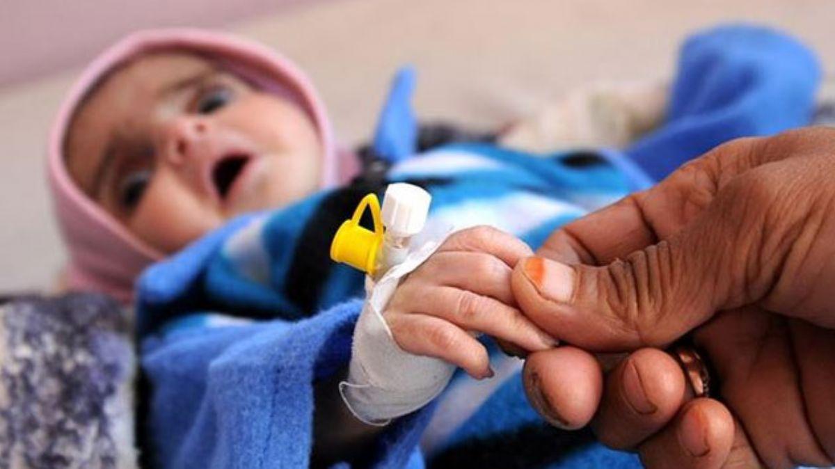 UNICEF: Yemen'de 12 milyon ocuk acil yardma muhta