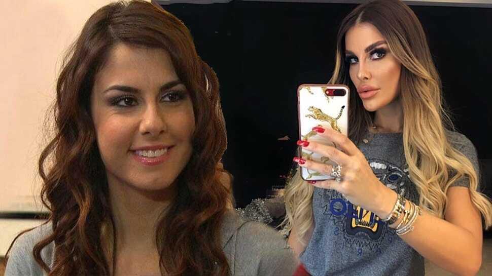 Adanalı dizisinin Pınar'ı Tuğçe Özbudak'tan estetik açıklaması