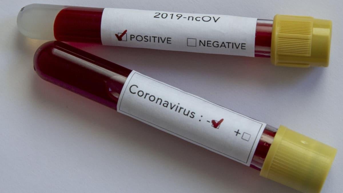 Endonezya'da ilk kez bir kii koronavirs nedeniyle ld