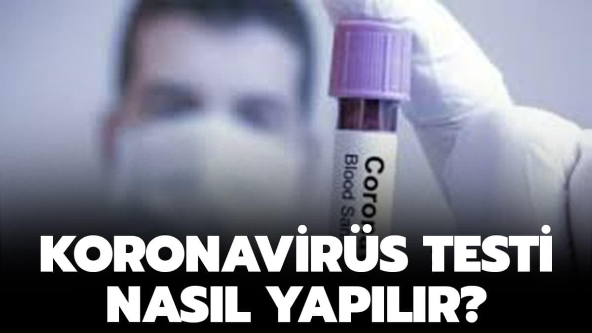 Koronavirs testi nasl yaplr"
