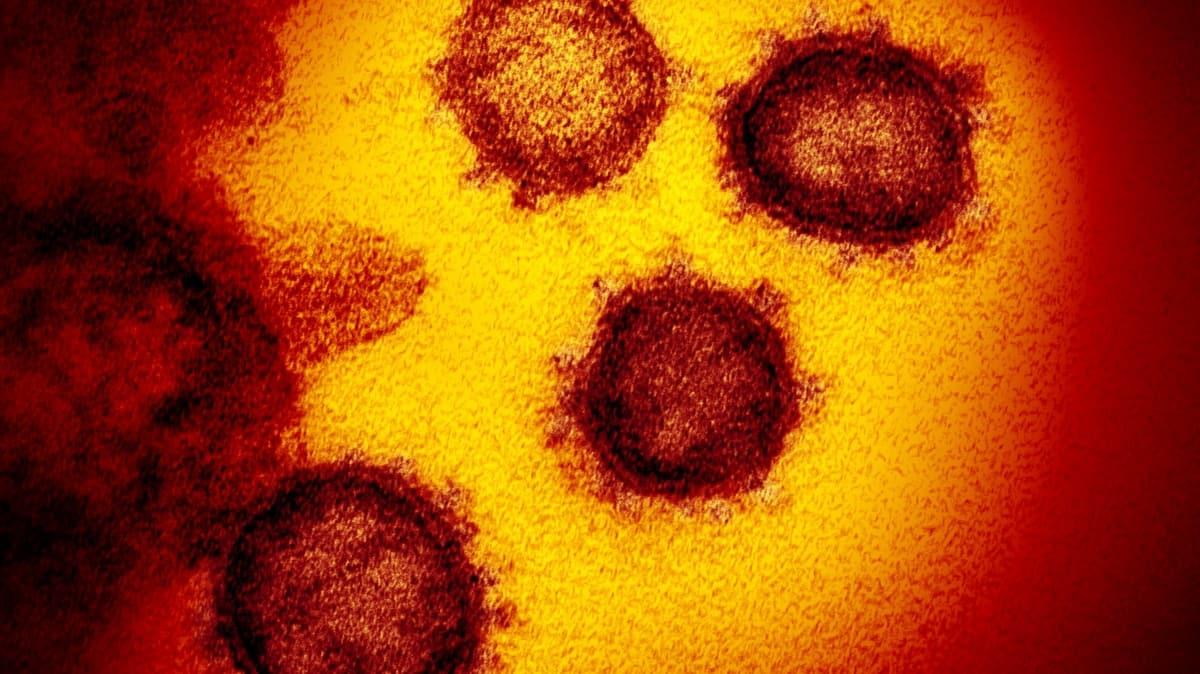 Koronavirsle iligli 1 milyondan fazla haber yapld