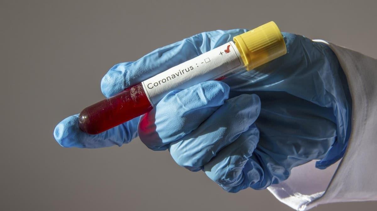 ABD'de koronavirs nedeniyle lenlerin says bini geti