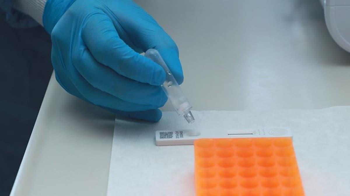 'Koranavirs Tan Laboratuvarlar' devrede! Trkiye'de 73 merkez test iin yetkilendirildi