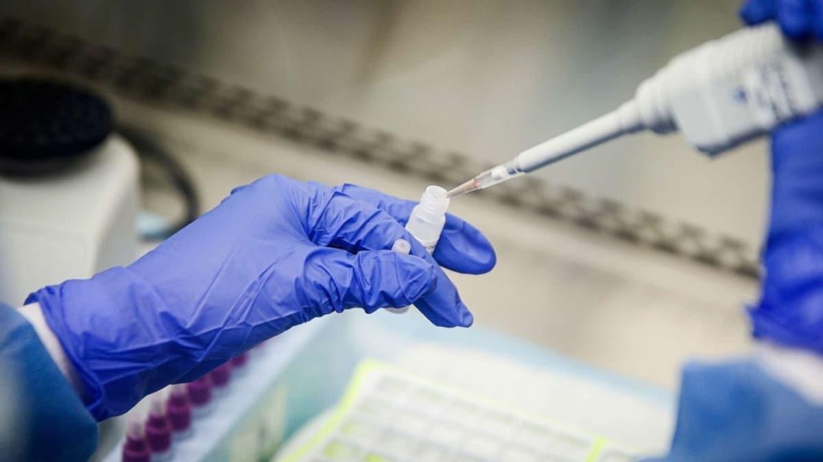 Koronavirs engellemek iin 50 hastanede Remdesivir ilac test edilecek