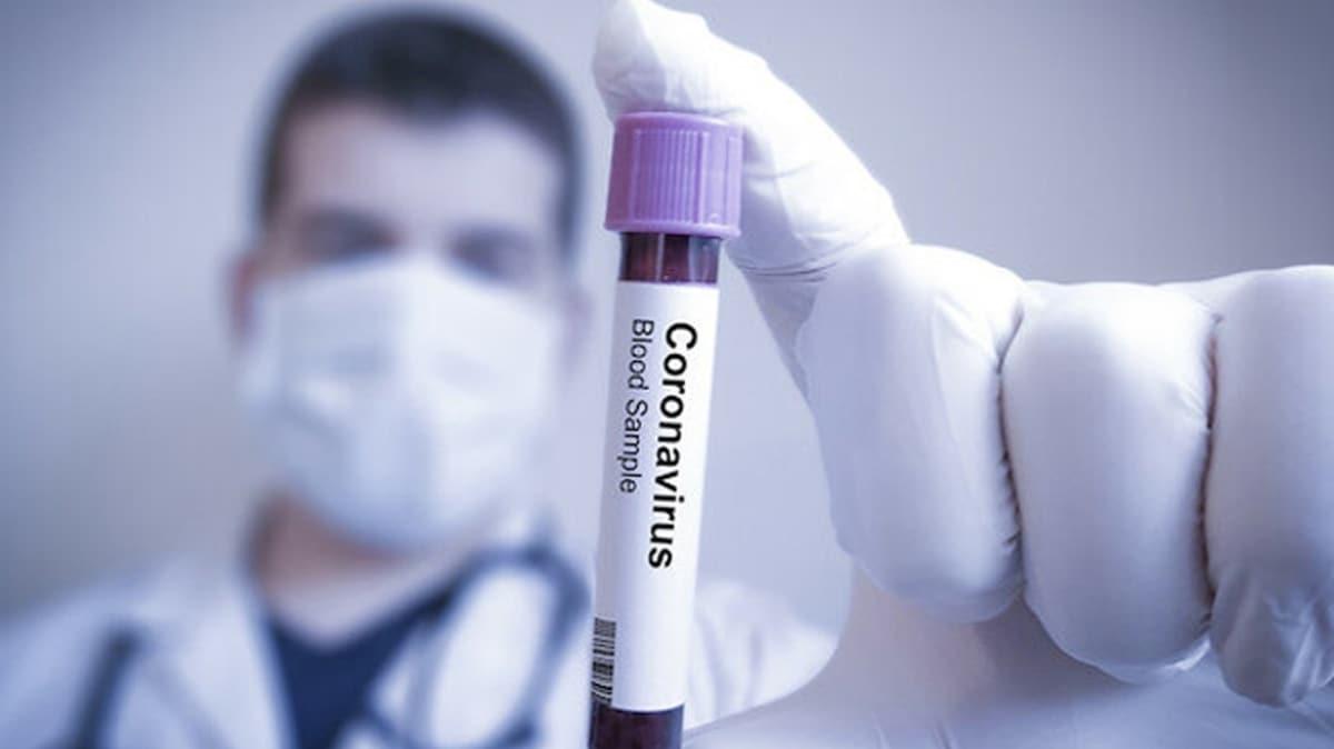 Bilim Kurulu yesi Prof. Dr. zl: Koronavirs testlerinde yeni bir aamaya geildi
