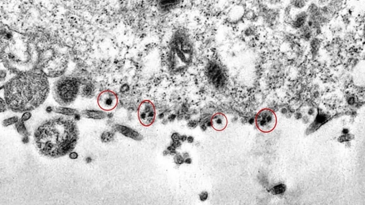 Bilim insanlar koronavirsn hcreye saldrd an grntledi