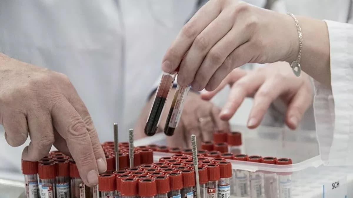 Singapurlu profesr koronavirsn 3 zelliine dikkat ekti! 'O hastalarn says sanlandan fazla... Bu, mcadeleyi zorlatryor'