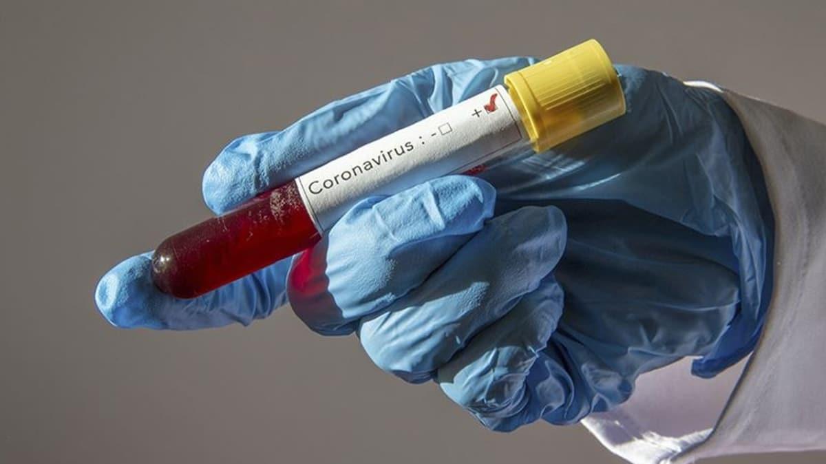 srail'de 8 gnlk bir bebein koronavirs testi pozitif kt