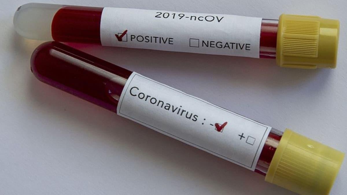 Antalya'da plazma nakledilen 78 yandaki koronavirs hastasnn testi negatife dnd