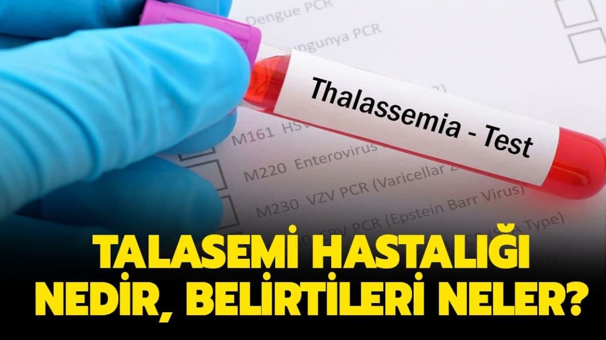 Talasemi belirtileri nelerdir" 