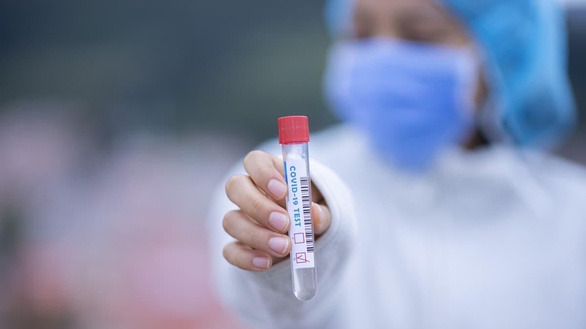 Dnya Salk rgtnden koronavirs uyars: HIV gibi kalc olabilir!