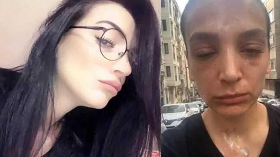 Lavabo çözücü bomba gibi patladı