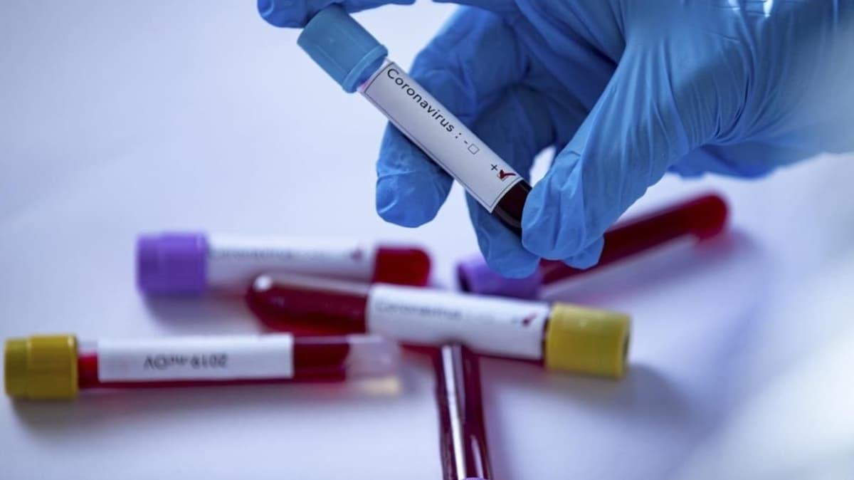 Koronavirüsün şiddeti, kan grubuna göre değişiyor mu" Bilim insanları yeni bir bulguya ulaştı