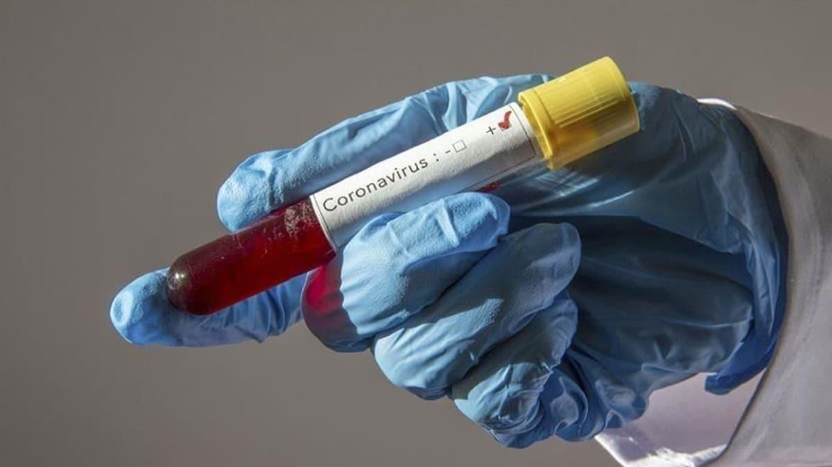 Kz isteme merasimine katlan kiide koronavirs tespit edildi, 5 ev karantinaya alnd!