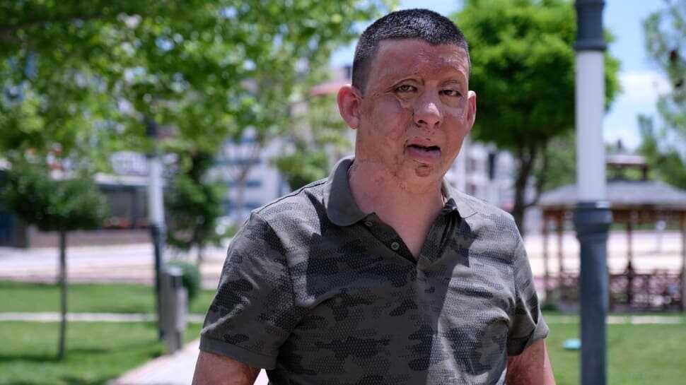Başkan Erdoğan'ın talimatıyla hayatı değişti: Allah onu başımızdan eksik etmesin