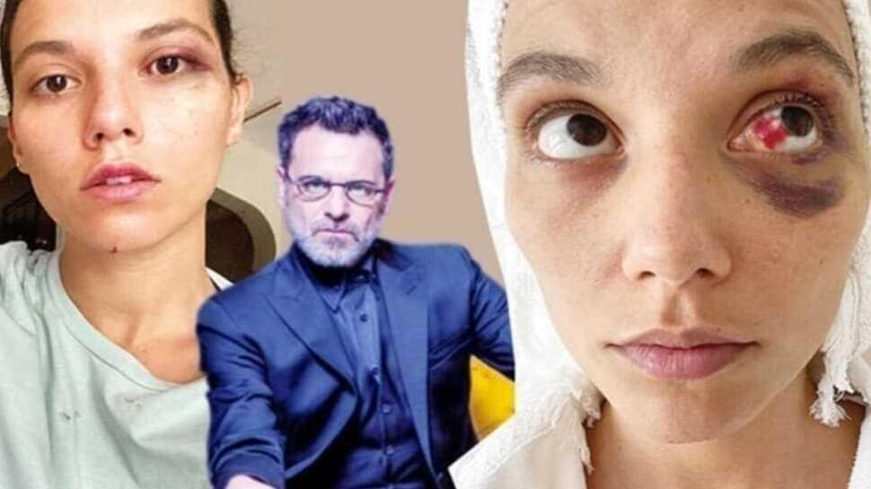 Ozan Güven kadına şiddet olayına tepki yağdı! Uzmanlar nasıl yorumladı"