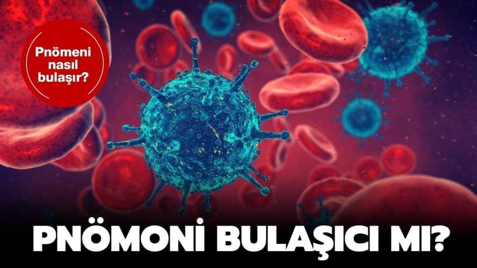 Pnömoni ne demek, belirtileri nelerdir"