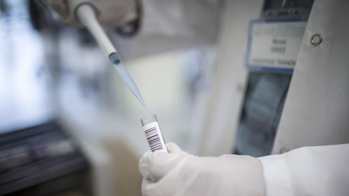 ngiltere'de hzl sonu veren koronavirs antikor testi gelitirildi