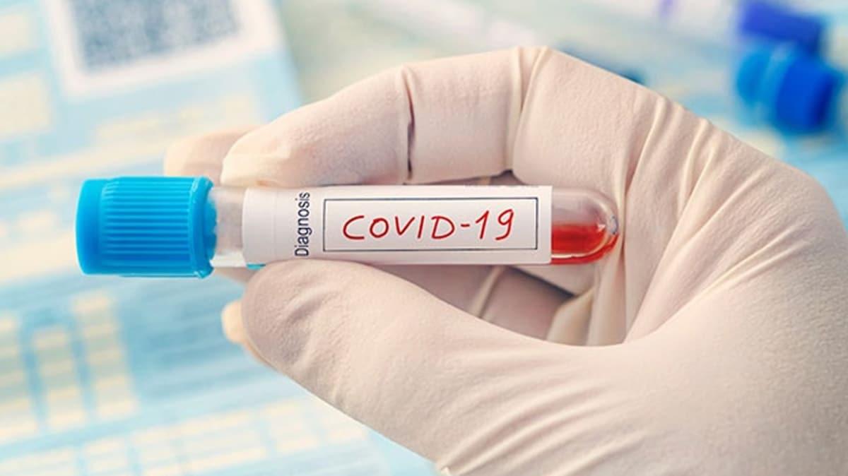 Fransa'da koronavirs testi aylar sonra cretsiz oldu