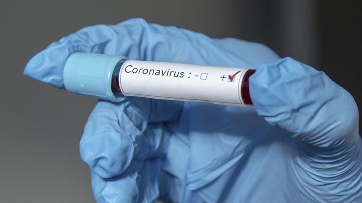 İsrailli bakanda koronavirüs tespit edildi