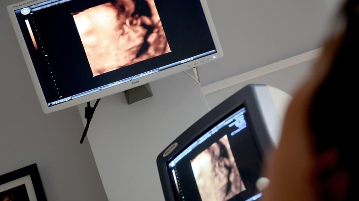 Gebelikte ultrason bebee zarar verir mi"