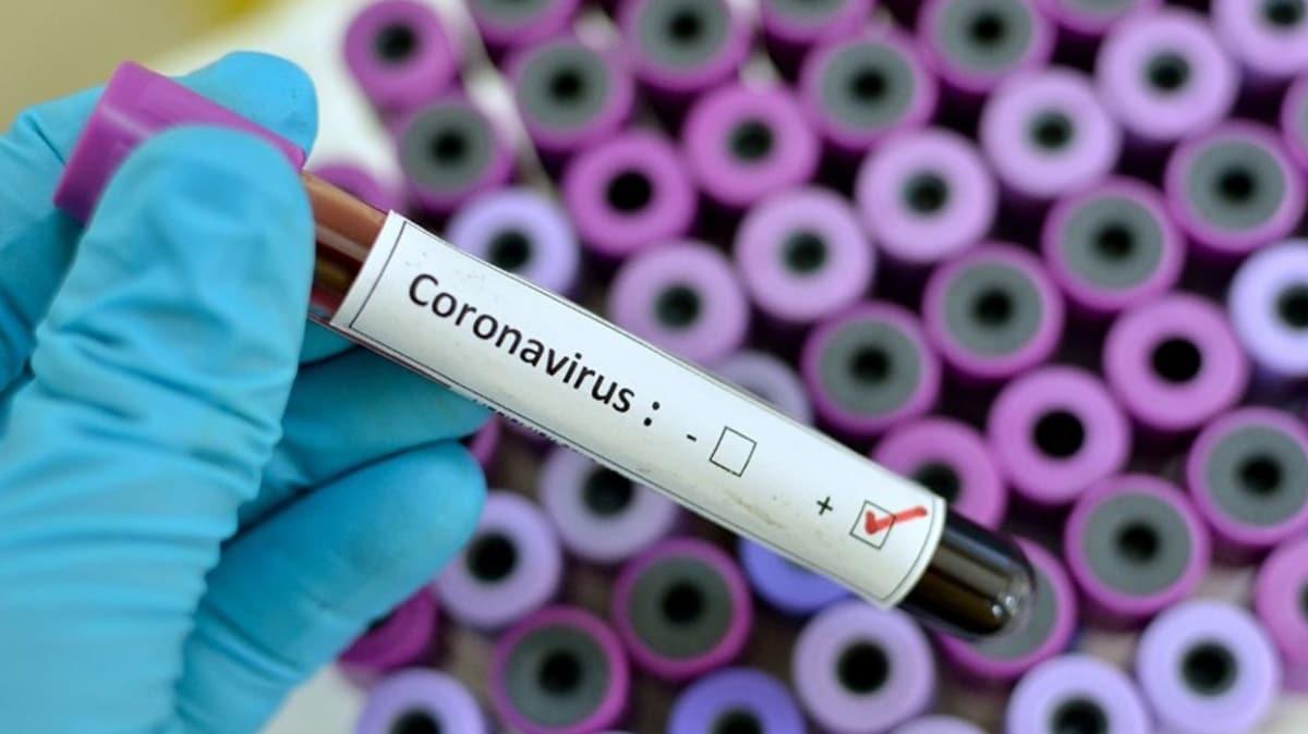Koronavirs'te son durum: Dnya genelinde vaka says 31 milyona yaklat